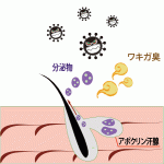 わきが臭の特徴